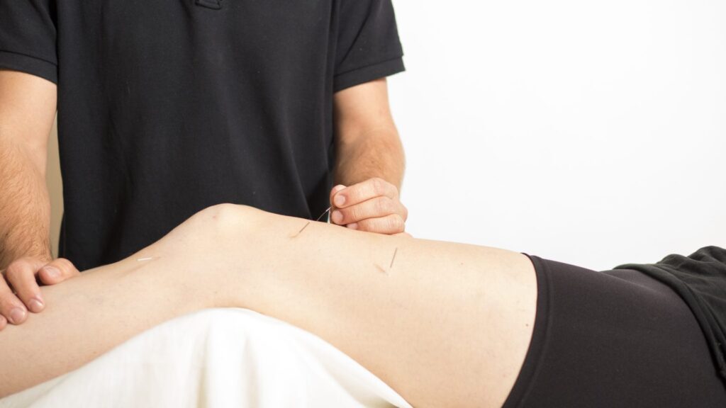 Fysioterapeut sætter akupunktur i ben på klient
