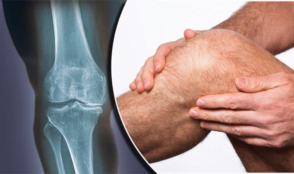 Ondt i knæet - Forskellige årsager knæsmerter | Sundhed Med Mening